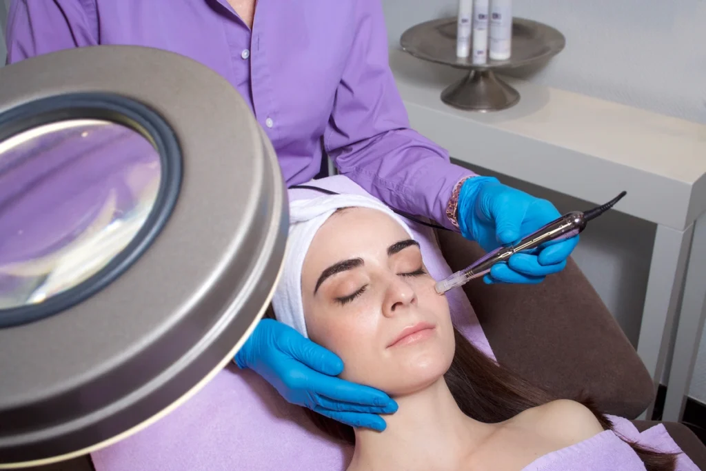 Microneedling Dermonic